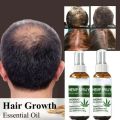 TRSTAY Hair Spray Hairloss Hair Tools Rosemary Oil for Hair Professional Brazilian Keratin New Hair Growth Essence Care Products. 