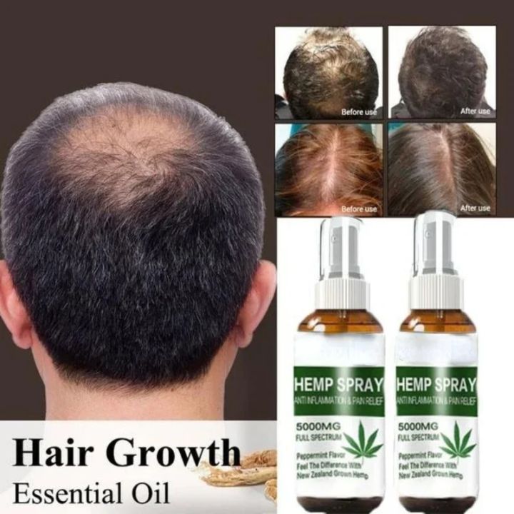 TRSTAY%20Hair%20Spray%20Hairloss%20Hair%20Tools%20Rosemary%20Oil%20for%20Hair%20Professional%20Brazilian%20Keratin%20New%20Hair%20Growth%20Essence%20Care%20Products%20-%20Image%202
