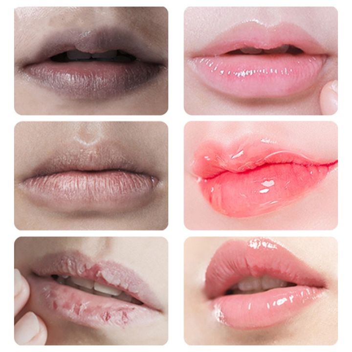 Lipstick%20Lip%20Gloss%20Repair%20Dry%20And%20Cracked%20Lips%20Moisturize%20And%20Moisturize%20To%20Remove%20Dark%20Lips%207G%20A%20Box%20For%20Men%20And%20Women%20Lip%20care%20Vnce%20Lncei%20-%20Image%205