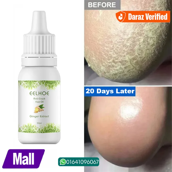 EELHOE%20Anti%20Crack%20Foot%20Hand%20Gel%20Ginger%20%20Cuticles%20Care%20Anti-Drying%20Healing%20Crack%20Frost%20Mask%20Dead%20Skin%20Removal%20Deep%20Moisturizing%20Feet%20Crack%20Whitening%20Smooth%20Feet%20Care%20-%20Image%203