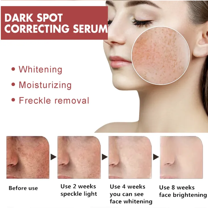 Hoygi%20Dark%20Spots%20Correcting%20Serum%20Niacinamide%2010%25%20+%20TXA%204%25%20+%20Arbutin,%20Reduces%20Dark%20Spots,%20Whitens%20&%20Brightens%20Skin%20-%20Image%208