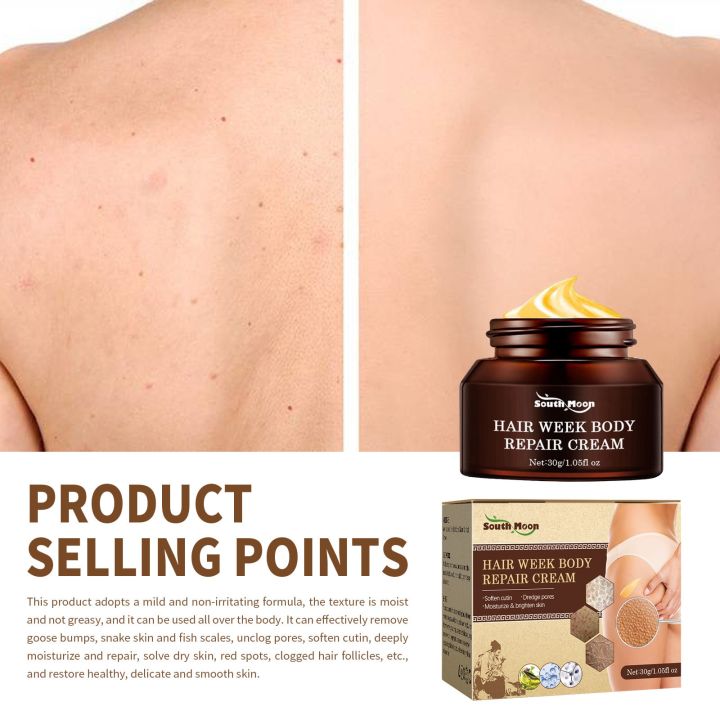 Keratosis%20Pilaris%20Removal%20Cream%20Chicken%20Skin%20Folliculities%20Treatment%20Repair%20Whitening%20Moisturizing%20Smooth%20Body%20Lotion%20-%20Image%203