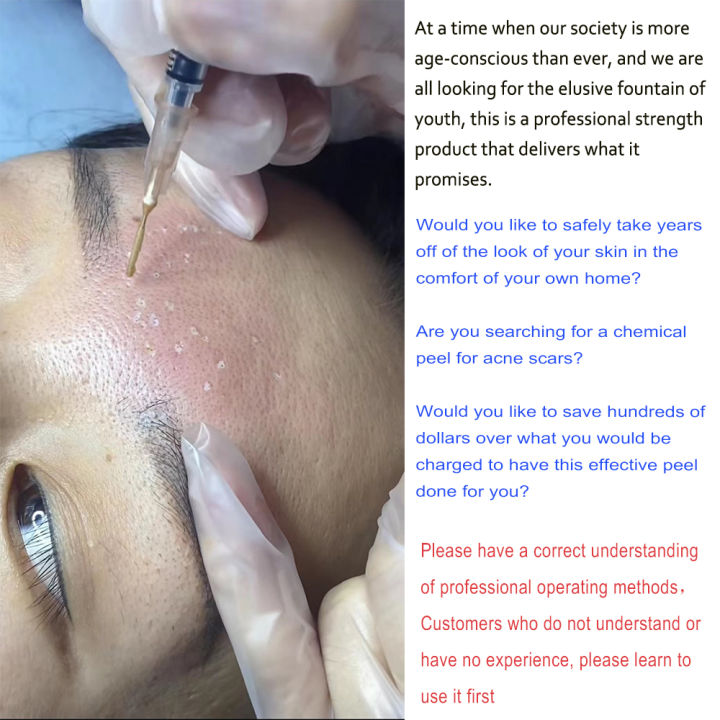 TCA%2020%25%2030%25%2035%25%2040%25%2050%25%2060%25%2070%25%20Pure%20TCA%20Peel%20Solution%20for%20Sun%20Damage%20Fine%20Lines%20Wrinkles%20Dull%20Skin%20Uneven%20Skin%20Tone%20Enlarged%20Po%20-%20Image%202
