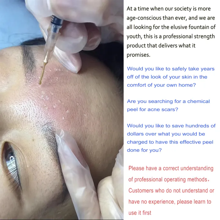 TCA%2020%25%2030%25%2035%25%2040%25%2050%25%2060%25%2070%25%20Pure%20TCA%20Peel%20Solution%20for%20Sun%20Damage%20Fine%20Lines%20Wrinkles%20Dull%20Skin%20Uneven%20Skin%20Tone%20Enlarged%20Po%20-%20Image%202