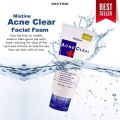 Mistine Acne Clear Facial Foam 85g. 