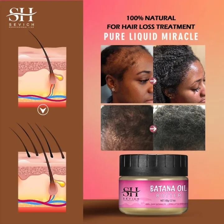 Natural%20100%25%20Pure%20Batana%20Oil%20For%20Hair%20Growth%20Batana%20Oil%20Butter%20Hair%20Mask%20From%20Honduras%20Hair%20Loss%20Treatment%20For%20Black%20Men%20Women%20-%20Image%204