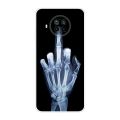 For Xiaomi Mi 10T Lite 5G Case Shockproof Soft silicone TPU Back Cover For Xiaomi Mi10T Lite 5G Phone Cases Mi 10 T Lite Coque.