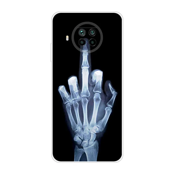 For%20Xiaomi%20Mi%2010T%20Lite%205G%20Case%20Shockproof%20Soft%20silicone%20TPU%20Back%20Cover%20For%20Xiaomi%20Mi10T%20Lite%205G%20Phone%20Cases%20Mi%2010%20T%20Lite%20Coque%20-%20Image%206