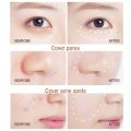 Eyes Face Concealer Liquid Cover Dark Circles Acne Natural Make Up Effect Anti Cernes Base Foundation Cream Cosmetics. 