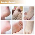 Feet Care Mask Foot Cream Hand Cracked Repair Cream Removal Dead Skin Hand Feet Care SkinTreatment Exfoliation. 