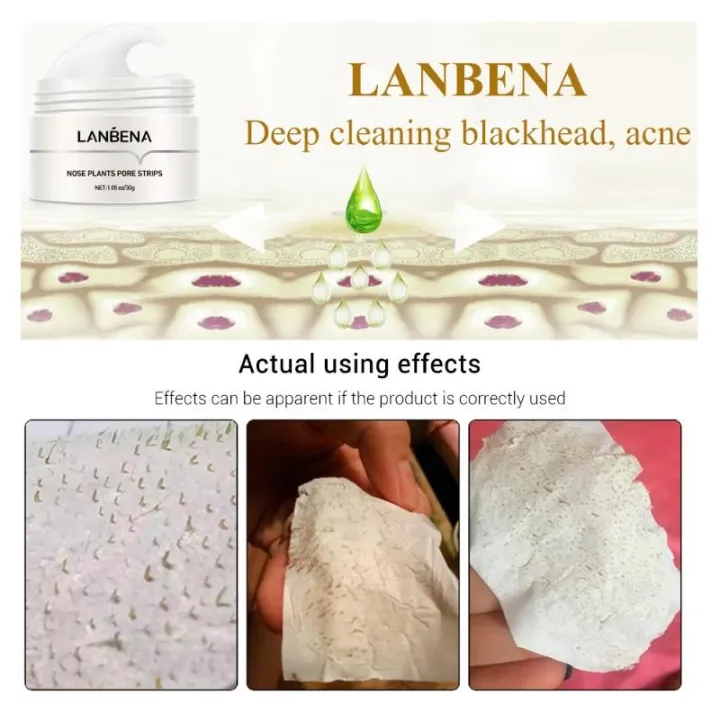 LANBENA%20Blackhead%20Remover%20Nose%20Mask%20Pore%20Strip%20Black%20Mask%20Peeling%20Acne%20Treatment%20Face%20Deep%20Cleansing%20Skin%20Care%20Korea%20Cosmetics%20-%20Image%206