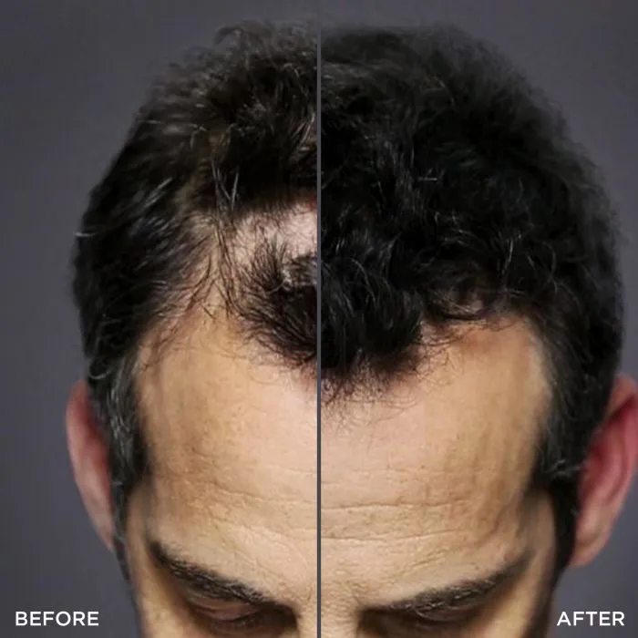 Toppik%20Hair%20Fiber%20Spray%20Applicator%20-%20Image%204