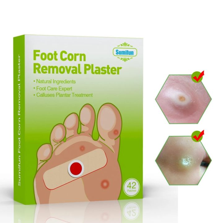 42pcs%20Corn%20and%20Callus%20Removal%20Foot%20Corn%20Remover%20Stickers%20Feet%20Callus%20Chicken%20Eye%20Treatment%20Sticker%20for%20Relieving%20Pain%20-%20Image%205