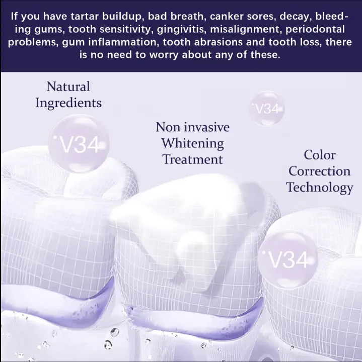 EELHOE%20DIAMOND%20GLITTER%20PRO%20WHITENING%20MOUSSE%20TOOTHPASTE%2050ML%20Professional%20Diamond%20Pro%20Whitening%20for%20Removing%20Yellow%20Teeth%20Stains%20&%20Ultra%20White%20teeth,%20immediate%20actions%20with%20guaranteed%20result%20-%20Image%204