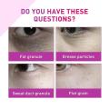 Fat Granules Removal Eye Serum Eye Milia Repair Treatment Products Wrinkle Lifting Moisturizing Anti-Puffiness Korean Skin Care.