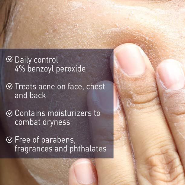 Panoxyl%20Acne%20Creamy%20Wash%20Benzoyl%20Peroxide%204%25%20-170g%20-%20Image%205