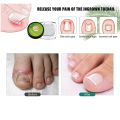 10PCS Ingrown Toenail Correction Tool Nail Treatment Toe Nail Sticker Foot Care Pedicure Foot Orthodontic Toe Thumb Nail Patches. 