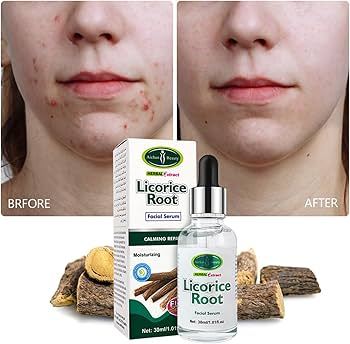 Aichun%20Beauty%20Licorice%20Root%20AntiInflammatory%20Facial%20Serum%2030ml%20-%20Image%202