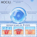 Acne Surgical Stretch Marks Removal Scar Cream Repair Smoothening Whitening Body Skin Care Pigmentation Beauty Cosmetics 20g AOutlierA. 