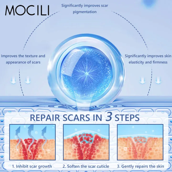Acne%20Surgical%20Stretch%20Marks%20Removal%20Scar%20Cream%20Repair%20Smoothening%20Whitening%20Body%20Skin%20Care%20Pigmentation%20Beauty%20Cosmetics%2020g%20AOutlierA%20-%20Image%205