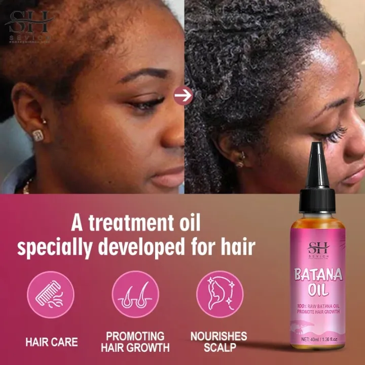 Natural%20100%25%20Pure%20Batana%20Oil%20For%20Hair%20Growth%20Batana%20Oil%20Butter%20Hair%20Mask%20From%20Honduras%20Hair%20Loss%20Treatment%20For%20Black%20Men%20Women%20-%20Image%205