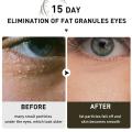 Fat Granules Removal Eye Serum Eye Milia Repair Treatment Products Wrinkle Lifting Moisturizing Anti-Puffiness Korean Skin Care.