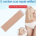 3PC Efficient Surgery Scar Removal Silicone Gel Sheet Therapy Patch for Acne Trauma Burn Scar Skin Repair Scar Treatment. 