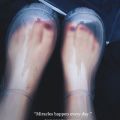 Transparent Rain Boots Crystal Shoes Women's New Transparent Boots Summer Rain Boots Jelly Women's Waterproof Rain Shoesins.