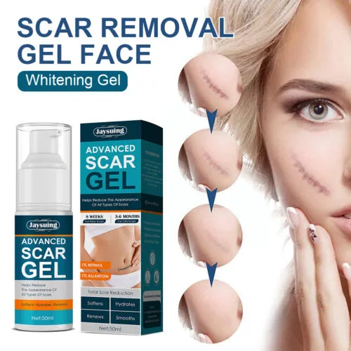 50ml%20Scar%20Removal%20Gel%20-%20Effective%20Stretch%20Mark,%20Acnes%20Spots,%20Burns%20and%20Surgical%20Scars%20Treatment%20Cream%20-%20Retinol,%20Allantoin,Vitamin%20E%20-%20Post%20Surgery%20Skin%20Repair%20Supplies%20No%20Side%20Effects%20-%20Image%202