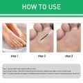 Corn Remover Strengthen Gel,Corn Remover Gel Extra Strength,Instant Blemish Removal Gel,Wart Remover Liquid,Corn Remover Liquid for Feet Toes Hands Care,Easy to Remove Calluses.