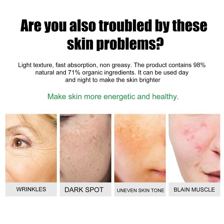 Aloe%20Vera%20Gel%20Anti%20Acne%20Treatment%20Pimples%20And%20Acne%20Remover%20Cream%20Facial%20Moisturizer%20Glowing%20Skin%20Korean%20Skin%20Care%20Products%2020g%20-%20Image%204