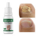 EELHOE Makes Your Nail Clean EELHOE Nail Repair Serum Nail Repair Oil 15ML.