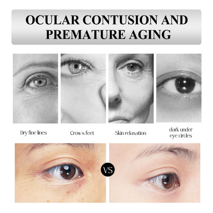 EELHOE%20Eye%20Serum%20Roll-On%20is%20a%20moisturizing%20eye%20cream%20that%20reduces%20the%20appearance%20of%20fine%20lines%20and%20dark%20circles%20around%20the%20eyes%20-%20Image%204