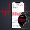 ChiBear 2024 New Bluetooth Call Smart Watch Women ECG+PPG Smartwatch Fashion Sport Health Ladies Watch Waterproof Girl Bracelets.