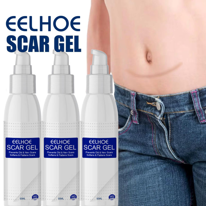 EELHOE%20Scar%20Removal%20Cream%20Gel%20Burn%20Surgical%20Scar%20Cesarean%20Scar%20Repairing%20Stretch%20Marks%20Pigmentation%20Corrector%20-%20Image%203