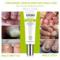 Nail Repair Gel | Efero Nail Cream Treatment. 