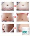 Natural Organic Postpartum Stretch Mark Removal Skin Repair Cream Body Pregnancy Scar Cream For Women.