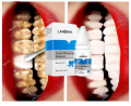 Lanbena Teeth Essence 10ml Teeth Whitening Essence. 