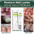 EFERO Anti Fungal Nail Repair Gel Treatment Anti Infection Serum Toe Nail Fungus Remover Nourish Essence Nail Care. 