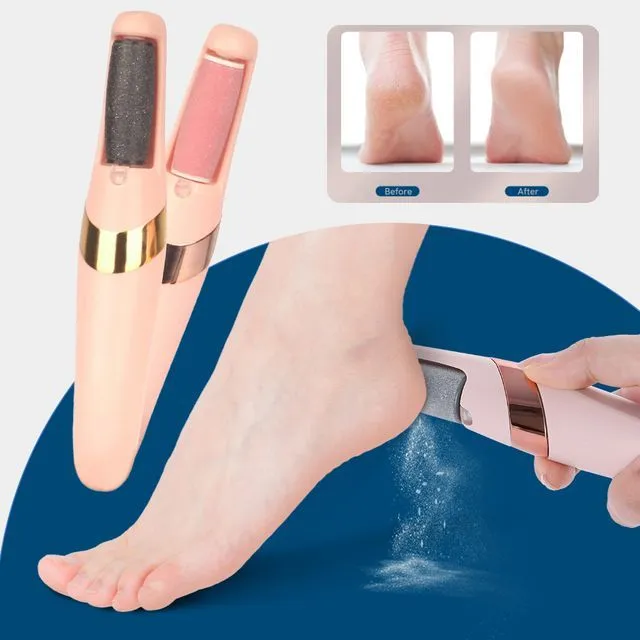 Electric Foot Callus Remover Foot File for Dead Hard Cracked Dry Skin ...