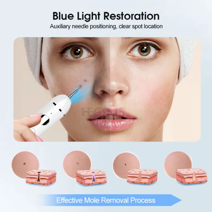 (NEW)%20Face%20Mole%20Removal%20Pen%20Spots%20Tattoo%20Freckle%20Removal%20Pen%20Skin%20Tag%20Remover%20LED%20Lighting%20Sweep%20Mole%20Removing%20Dark%20Spot%20Remover%20Skin%20Care%209%20Adjustable%20Modes%20Laser%20Mole%20Pen%20-%20Image%204