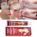 Feet Care Mask Foot Cream Hand Cracked Repair Cream Removal Dead Skin Hand Feet Care SkinTreatment Exfoliation. 