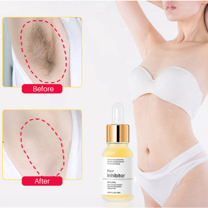 Permanent%20Hair%20inhibition%20Serum%20Hair%20Removal%20Serum%20Armpit%20Legs%20Arms%20Hair%20Growth%20Inhibitor%20Body%20Cream%20Mild%20Hair%20Nourishing%20Lotion%20-%20Image%205