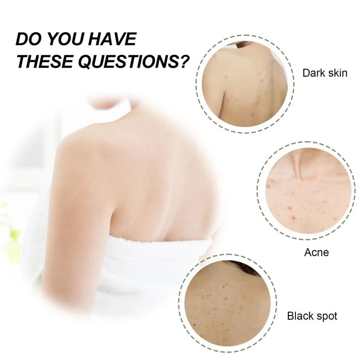 Exfoliating%20Gel%20Peeling%20Fade%20Acne%20Marks%20Dark%20Spot%20Dead%20Skin%20Removal%20Whitening%20Moisturizing%20Smooth%20Exfoliator%20Turmeric%20Body%20Scrub%20-%20Image%206