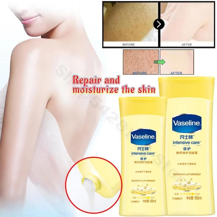 Vaseline Repairing Body Lotion 100ml Whitening Moisturizing Improves Dry Peeling Repairs Damaged Skin Barrier Fine Pores