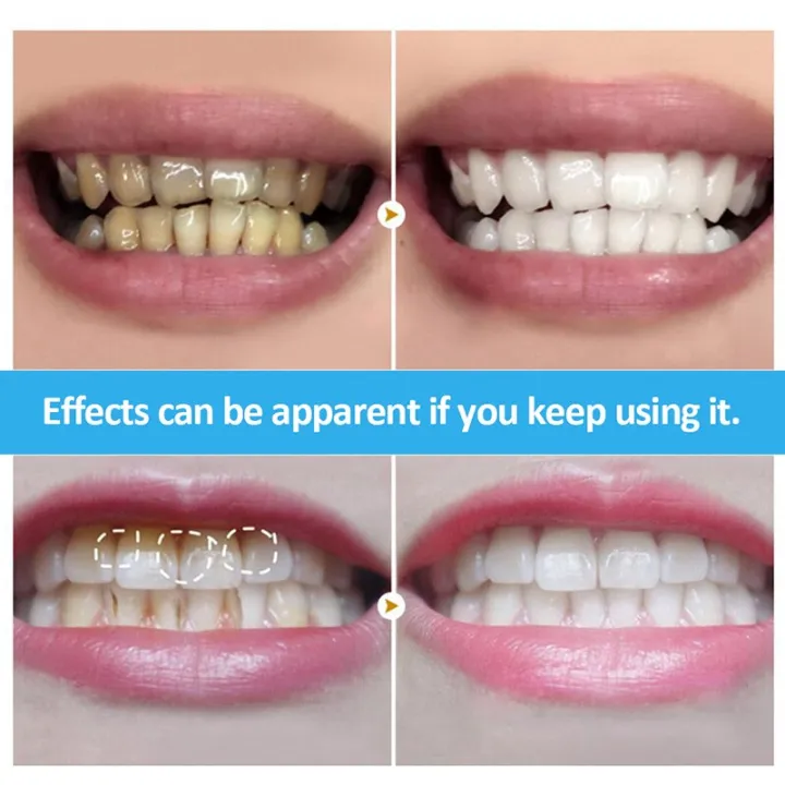 %E3%80%90Mary%20DAI%20Store%E3%80%911PC%20Ultra-thin%20Super%20Soft%20Toothbrush%20Portable%20Eco-friendly%20Travel%20Outdoor%20Use%20Teeth%20Care%20Brush%20Oral%20Oral%20Too%20-%20Image%204