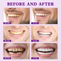 SP-7 Probiotic Toothpaste, Yayashi Sp-7 Toothpaste Whitening. 
