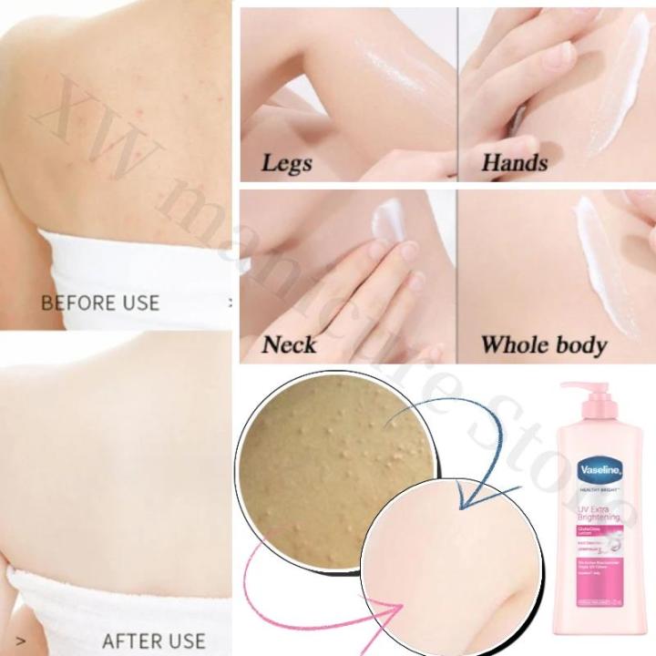 Vaseline%20Niacinamide%20Body%20Lotion%20Relieves%20Dry%20and%20Dehydrated%20Skin%20Exfoliates%20and%20Brightens%20Skin%20Tone%20Hydrating%20Body%20Lotion%20-%20Image%204