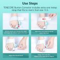 Unisex Orthopedic Bunion Corrector Splint Toe Straightener Adjustable Knob Hallux Valgus Toe Corrector Pedicure Foot Care Tools. 
