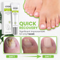 Nail Cream Treatment Repair Gel. 